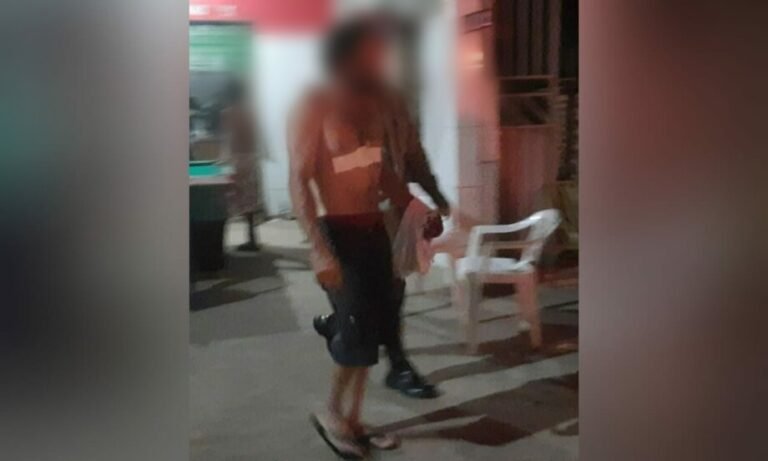 Briga de casal termina com homem ferido em bar de Itaituba