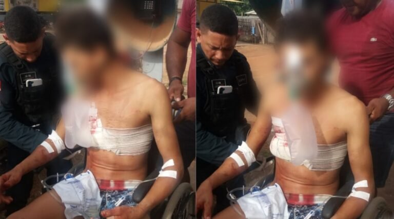 Menor de 17 anos sofre de tentativa de homicídio na região garimpeira de Itaituba