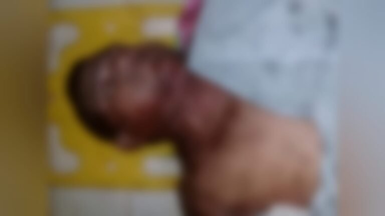 Homem morre após ser atingido por tiro no pescoço, em Trairão