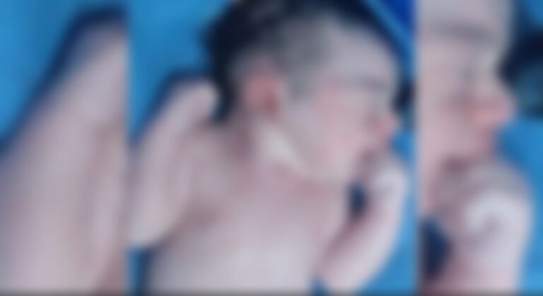 Mulher dá à luz em via pública no Distrito de Miritituba