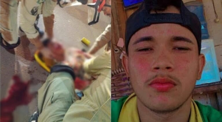 Jovem morre no HRT após grave acidente na rodovia transamazônica em Itaituba, PA