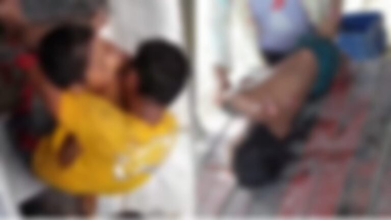 Criança morre ao ser atacado por jacaré no Rio Tapajós