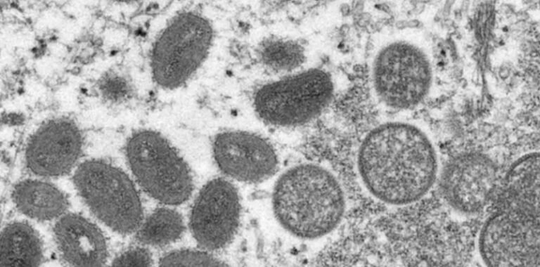 Sobe para cinco o número de casos confirmados de varíola dos macacos no Brasil