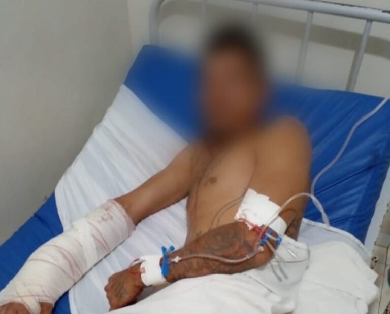 Suspeito de furto tem a mão quase decepada em Medicilândia PA
