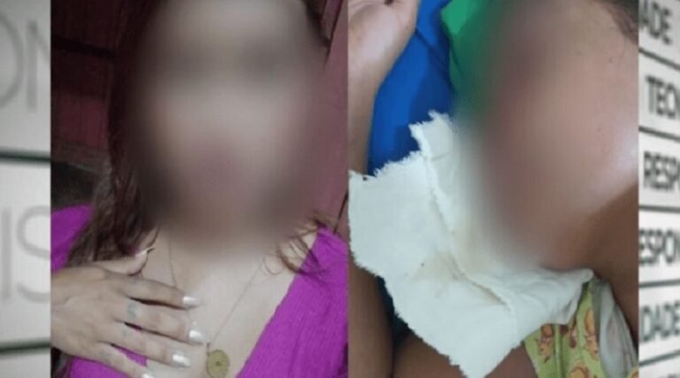 Garçonete entra em coma após ser espancada por cliente em Medicilândia (PA)