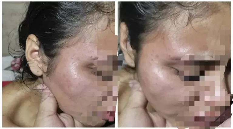 Mulher denuncia tentativa de estupro por suposto Policial Militar em Santarém no Pará