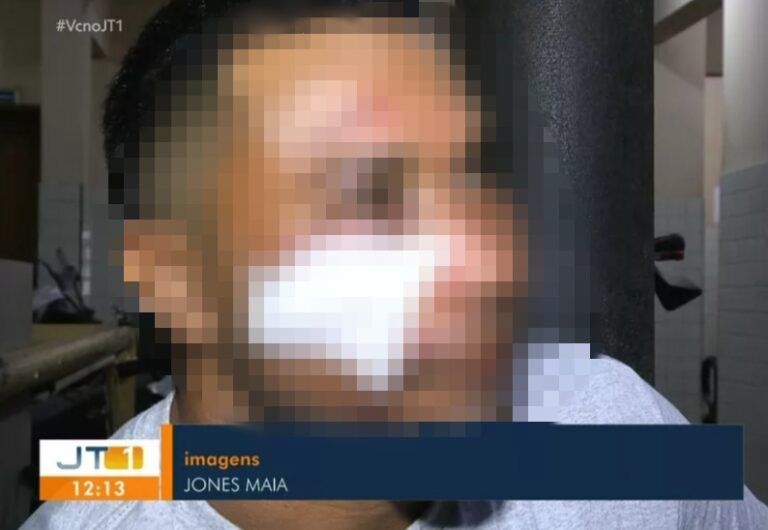 Homem leva várias pancadas na cabeça e fica desacordado após ser vítima de assalto no bairro Livramento, em Santarém