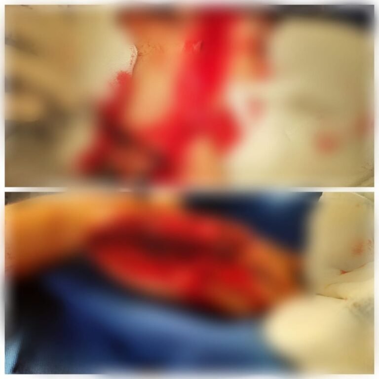 Uruará: Mulher leva corte de facão no rosto em tentativa de homicídio, autor acabou preso