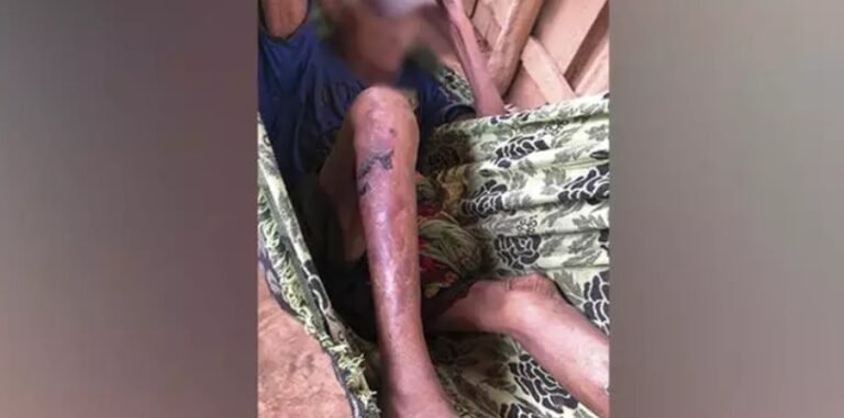 Idoso abandonado pela família é resgatado em situação precária em Pacajá, no Pará