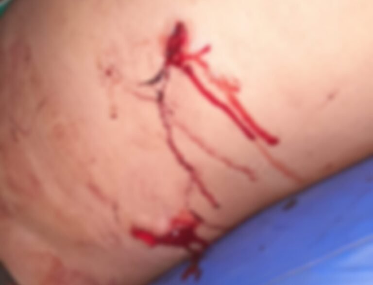 Homem é atingido por três golpes de faca na região garimpeira de Itaituba