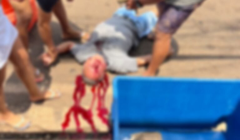 Homem após ser baleado morre no hospital em Altamira, no PA
