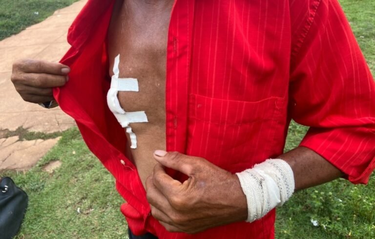 Homem de 51 anos é vítima de tentativa de homicídio