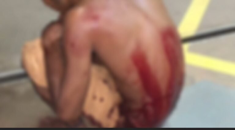 Jovem é esfaqueado em frente ao posto de combustível em Itaituba, no PA