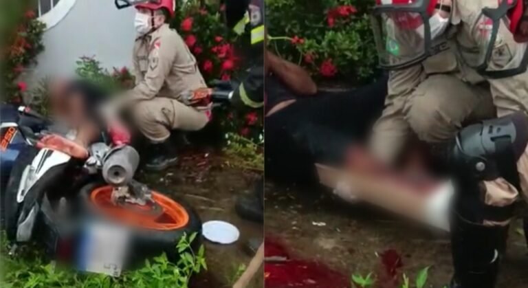 Homem cai de moto e tem objeto cravado em sua perna no município Itaituba, no PA