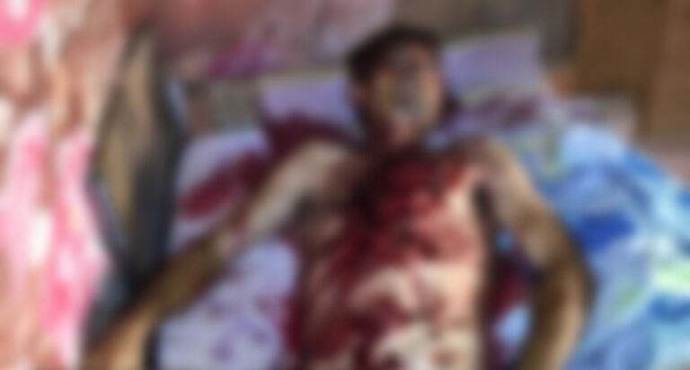 Homem é morto a facadas no Distrito de Cachoeira da Serra, no PA