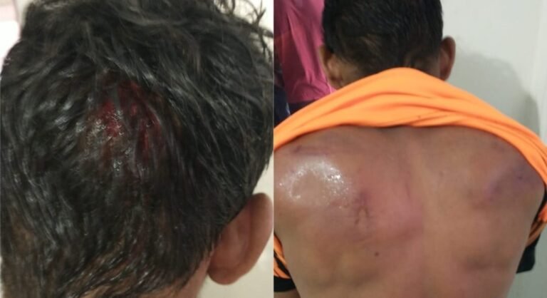 Homem é linchado por populares no Distrito de Moraes Almeida, no PA