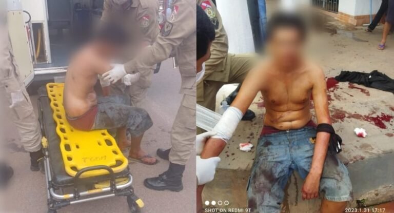 “Gordo Magro” é golpeado por arma branca no bairro Bela vista em Itaituba, no PA