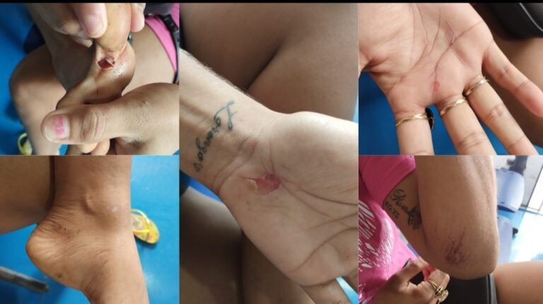 Mulher é agredida na comunidade Pimental