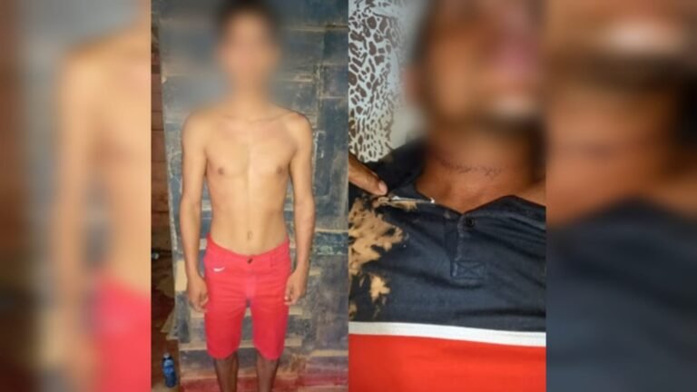 Motociclista é esfaqueado no pescoço após dar carona para suspeito em garimpo de Itaituba