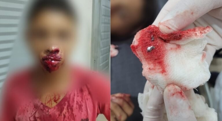 Menor infrator é baleado no município de Uruará