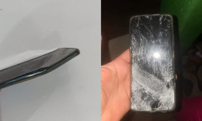 Celular no bolso evita grave fratura de motociclista em acidente no bairro Jardim das Araras, em Itaituba