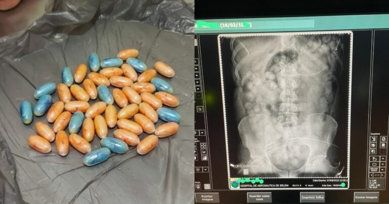 PF prende homem com 80 cápsulas de droga no estômago