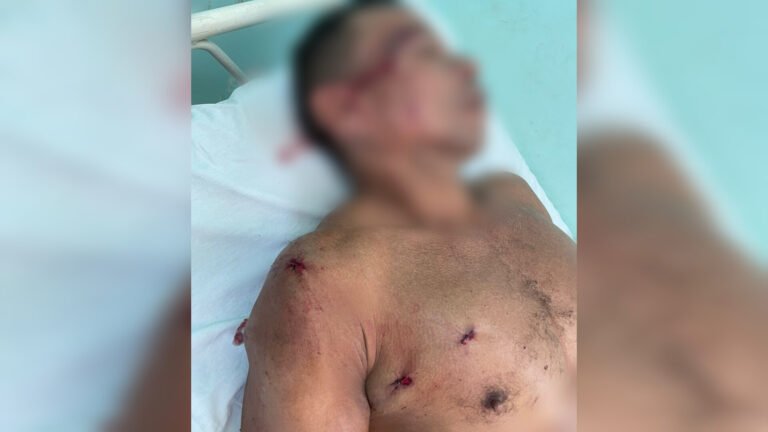 Homem é alvejado a tiros no bairro bela vista