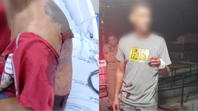 Homem esfaqueado fica com faca cravada na costa em Itaituba, no PA