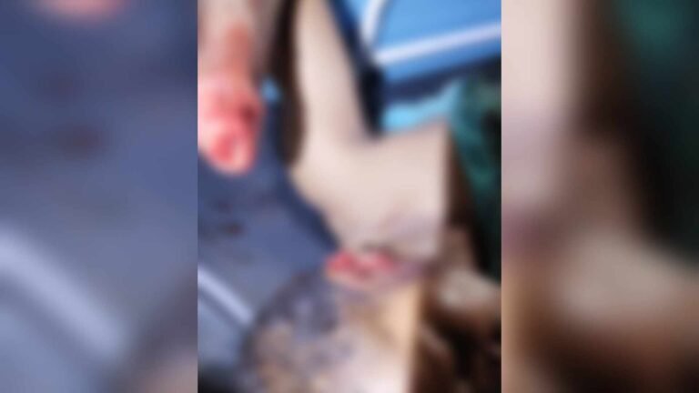 Homem tem mão decepada e orelha cortada