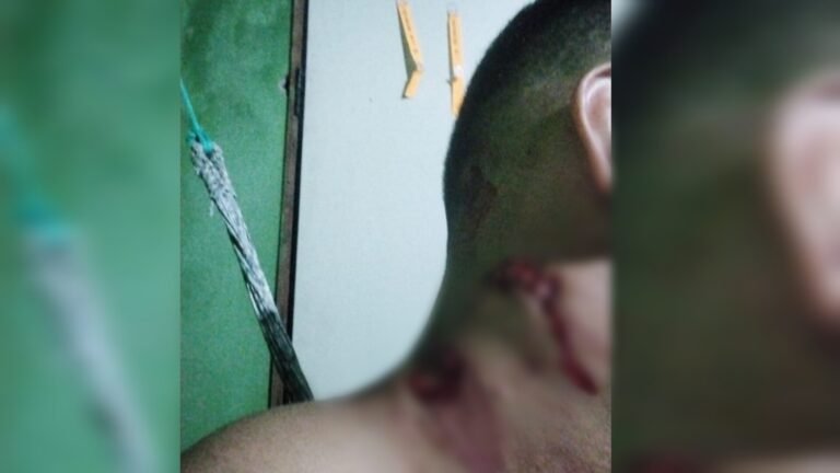 Jovem é golpeado no pescoço em festa de réveillon em Jacareacanga