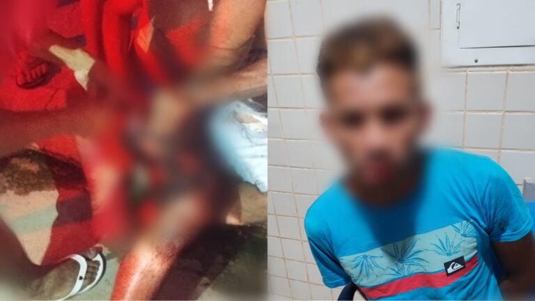 Homem é esfaqueado na perna direita em Itaituba, no PA