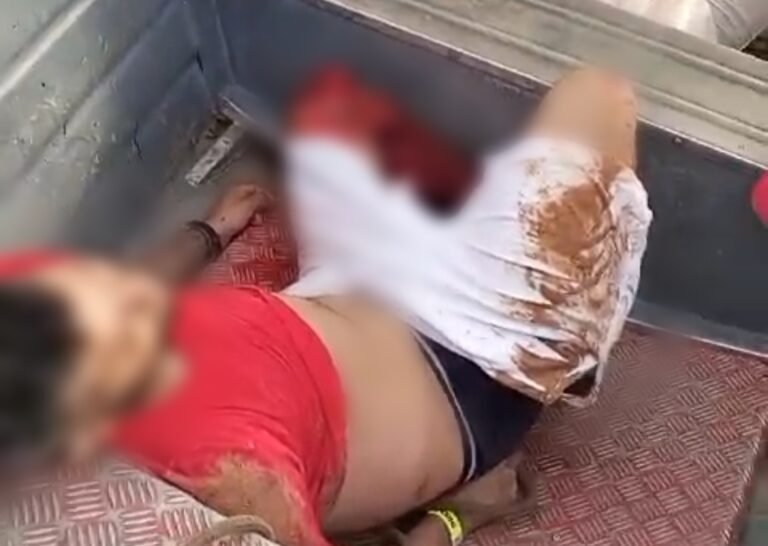 Vídeo: Jovem tem perna esmagada ao pular de balsa em movimento no Distrito de Miritituba