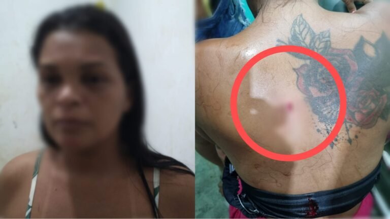 Mulher tem faca cravada nas costas na comunidade de água branca