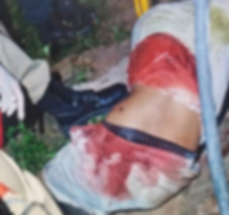 Homem sofre tentativa de homicídio em Itaituba, no PA