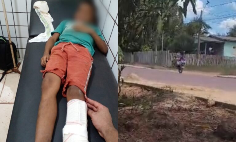 Motociclista atropela criança ao empinar moto em via pública