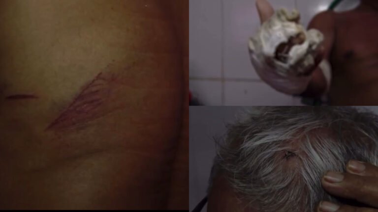 Ladrão Invade Residência e Agride Idosos em Altamira