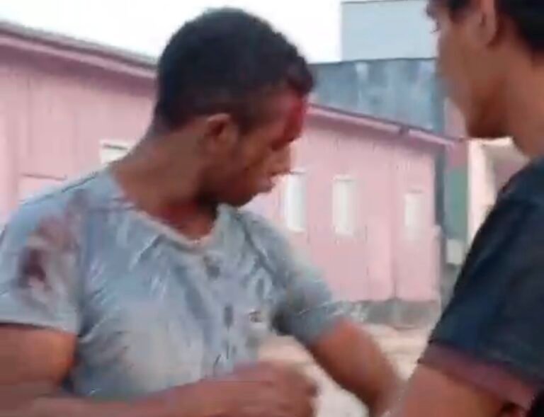 Desentendimento em Novo Progresso Resulta em Ferido