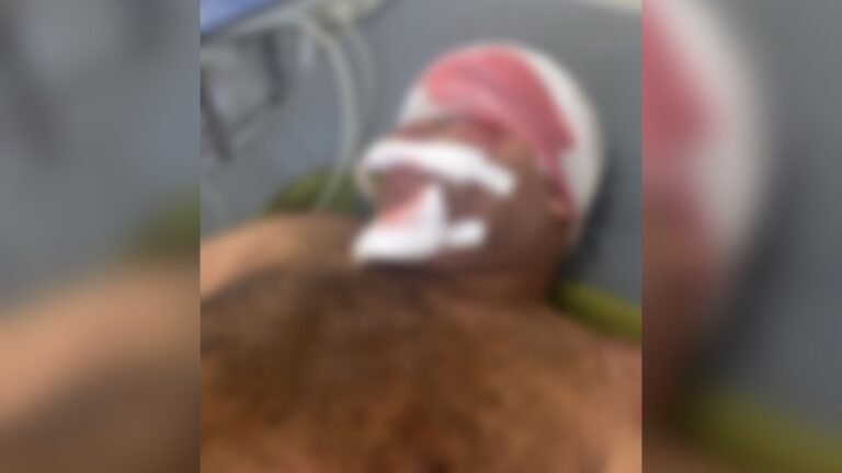 Vídeo: Grave acidente em frente à UPA 24h em Itaituba deixa vítima ferida