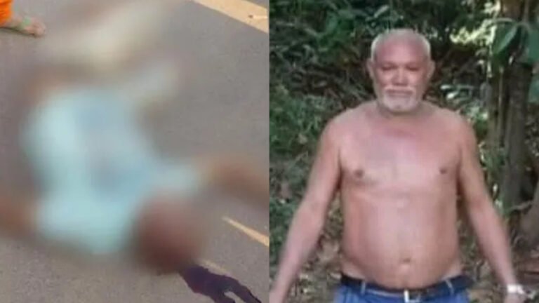 Homem de 59 anos morre em hospital após acidente em Uruará, no Pará