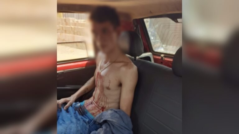 Jovem de 28 anos foi Baleado e Socorrido Após Disparos de Arma de Fogo em Itaituba, no Pará