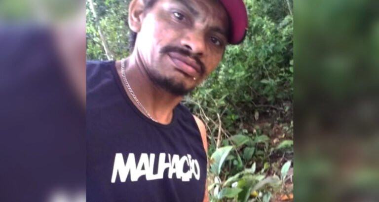 Homem morre no HRT 18 dias após acidente enquanto trafegava de bicicleta em Itaituba, PA 