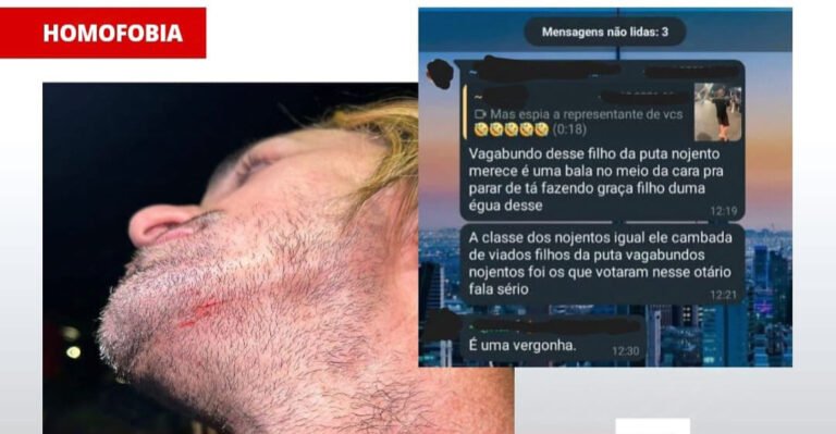 Vereador Biga Kalahare é atingido por projétil de arma de pressão após reeleição em Santarém, no Pará