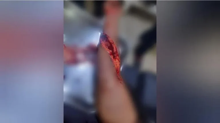 Briga entre Mulheres em Uruará Termina com Ferimentos Graves