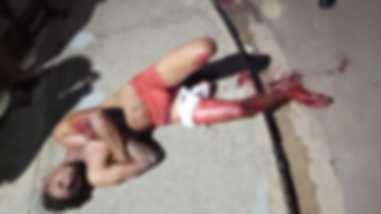 Homem é encontrado ferido a golpe de faca em via pública em Itaituba