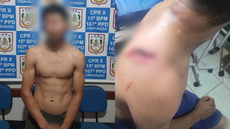 Esfaqueamento em Crepurizão expõe suspeita de abuso sexual