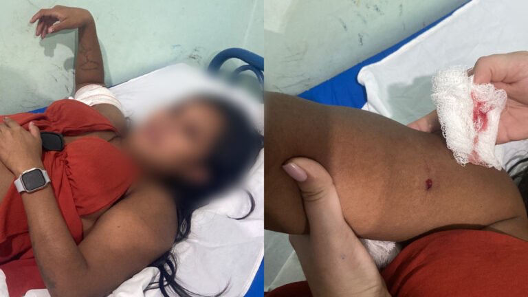 Mulher indígena é baleada no braço durante confusão em via pública em Jacareacanga