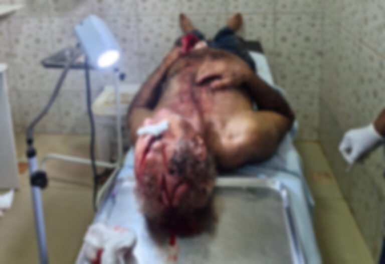 Homem dá entrada em hospital com ferimentos de arma branca em Rurópolis