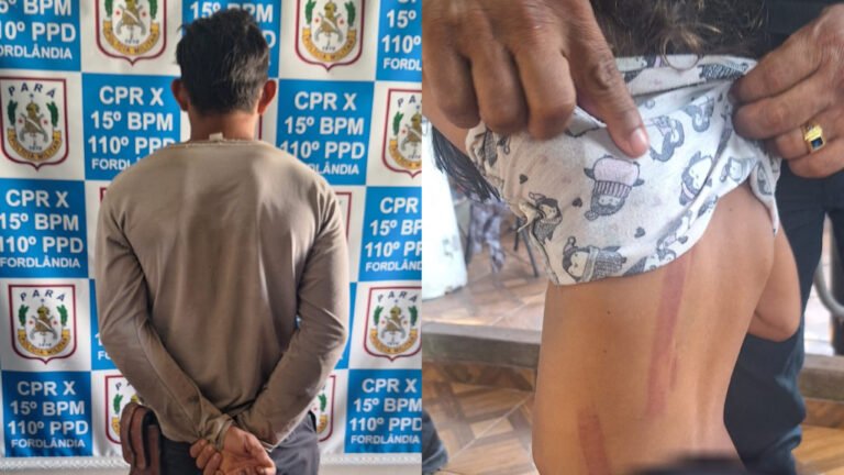 Pai é conduzido à delegacia após suspeita de agressão contra filha em Fordlândia