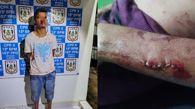 Mulher é esfaqueada pelo ex-companheiro e suspeito é preso em Moraes Almeida