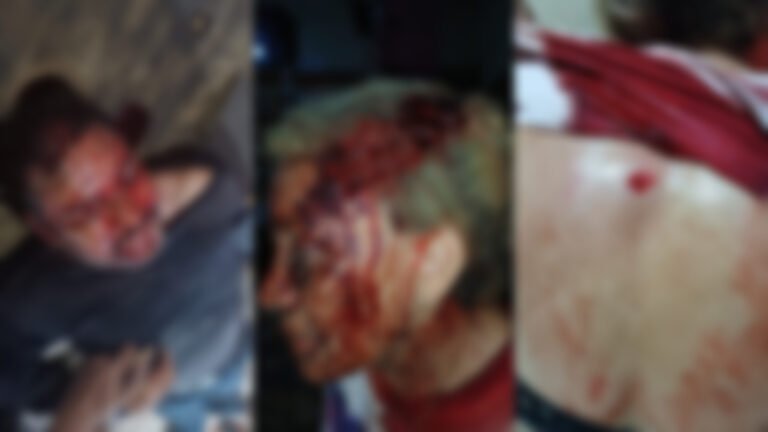 Garimpeiro é morto durante assalto em região garimpeira de Itaituba